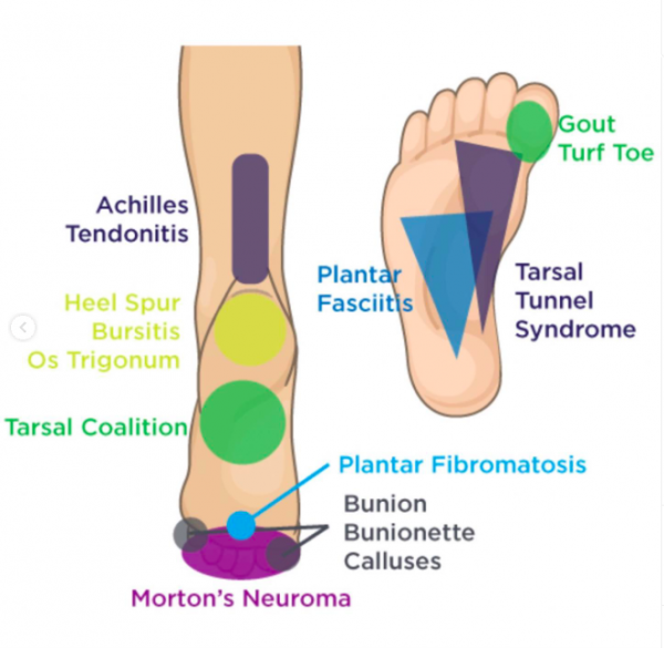 foot illness 1