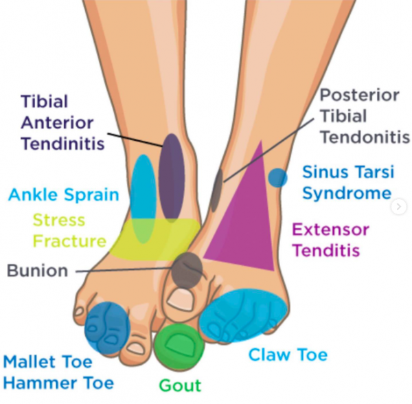foot illness 2